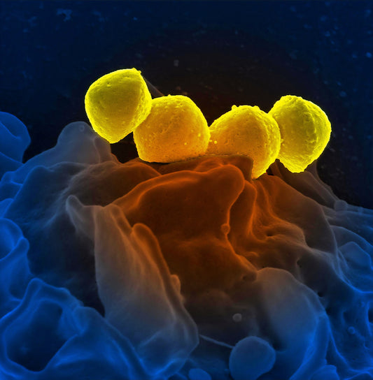 Boosting your immunity: is it about battening down the hatches – being fighting fit – or both?